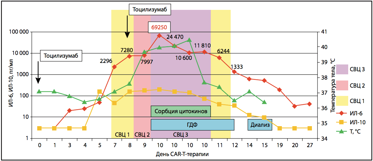 Extracorporeal adsorption of cytokines in cytokine release syndrome in a patient with acute lymphoblastic leukemia after therapy with T cells with a chimeric antigen receptor. Clinical observation